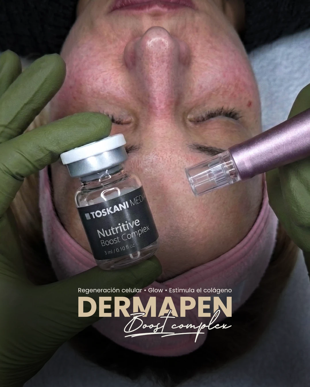 Publicación de Karen Escalona: tratamiento Dermapen Boost Complex